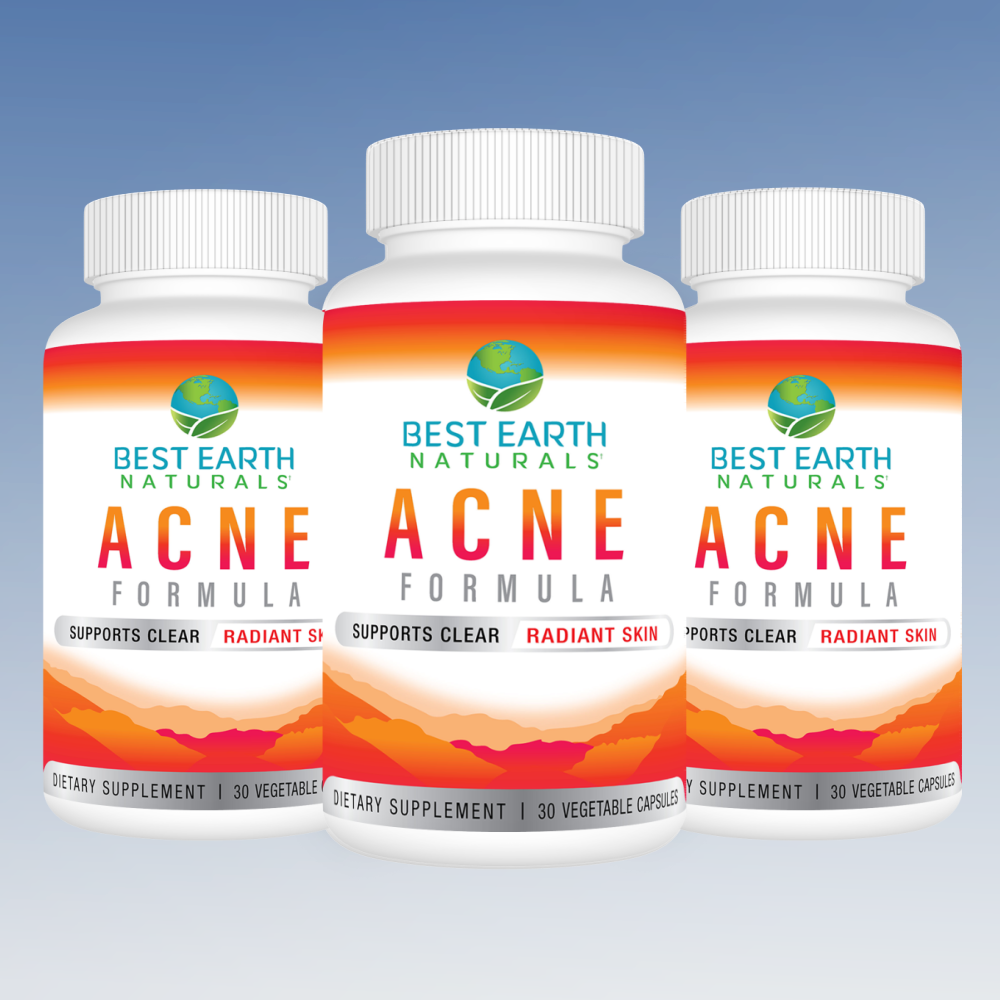 Acne Formula